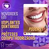 IMPLANTE DENTÁRIO PODCAST - Clínica ImplArt - Sorriso Digital e Implantes Dentários com Tecnologia portada