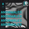 Anormales El Podcast portada